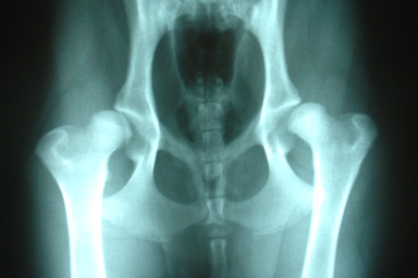 La displasia dell'anca